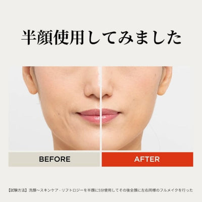 リフトロジーSP